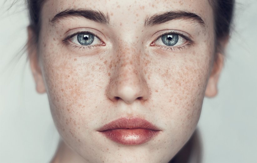 همه چیز درباره‌ی کرم ضد لک؛ ترکیبات، نحوه‌ی مصرف و پرفروش‌ها